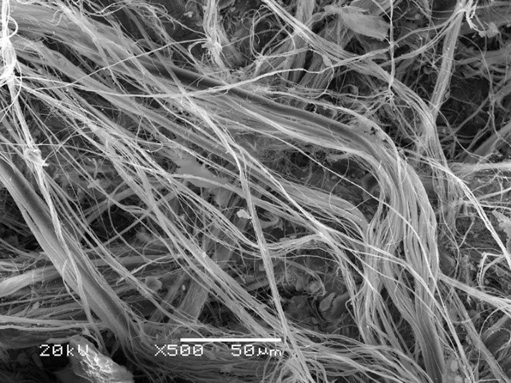 A la imatge veiem un garbuix de fibres corbes del grup dels serpentins